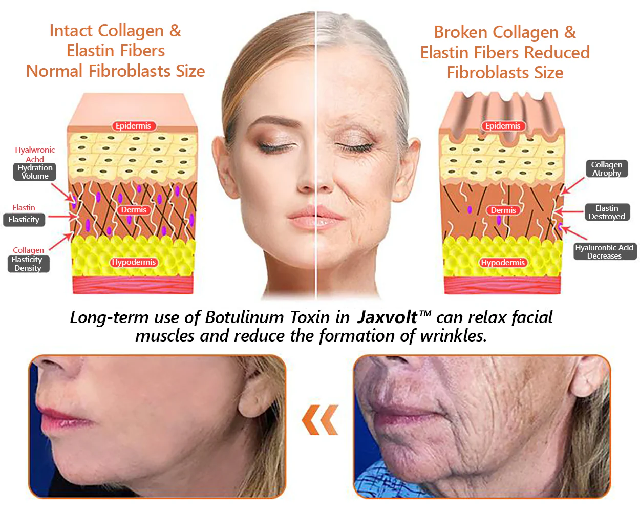 Jaxvolt™ 𝗕𝗼𝘁𝗼𝘅 𝗕𝗲𝗲 𝗩𝗲𝗻𝗼𝗺 𝗔𝗹𝗹-𝗶𝗻-𝗢𝗻𝗲 𝗥𝗲𝗽𝗮𝗶𝗿 𝗖𝗿𝗲𝗮𝗺 — 𝗖𝗲𝗿𝘁𝗶𝗳𝗶𝗲𝗱 𝗯𝘆 𝗔𝘂𝘀𝘁𝗿𝗮𝗹𝗶𝗮𝗻 𝗗𝗲𝗿𝗺𝗮𝘁𝗼𝗹𝗼𝗴𝗶𝘀𝘁𝘀