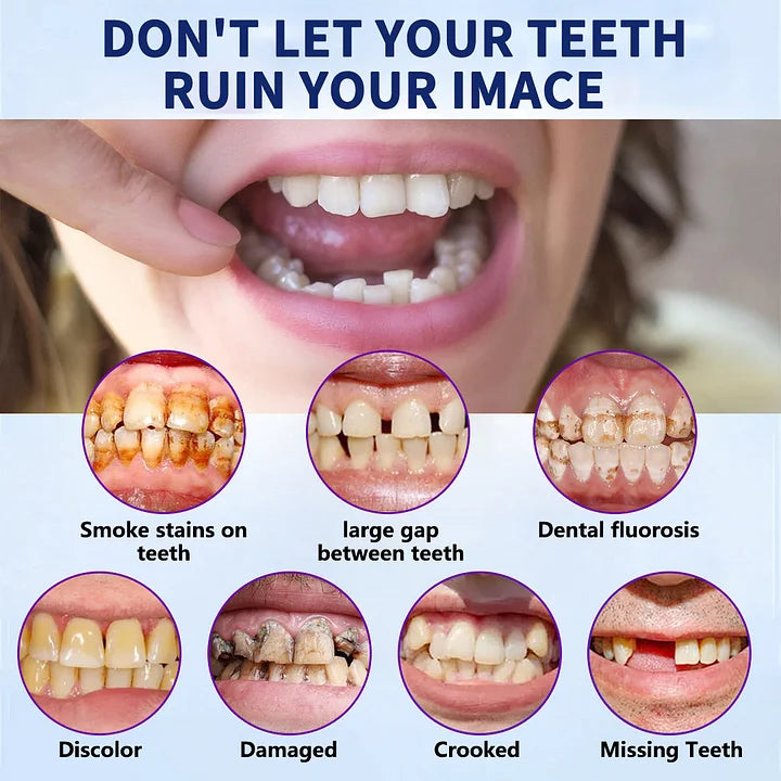 NESLEMY™-Advanced Customized Full Denture Set