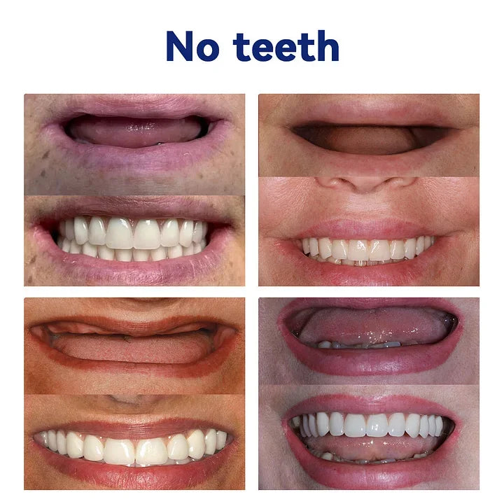 NESLEMY™-Advanced Customized Full Denture Set